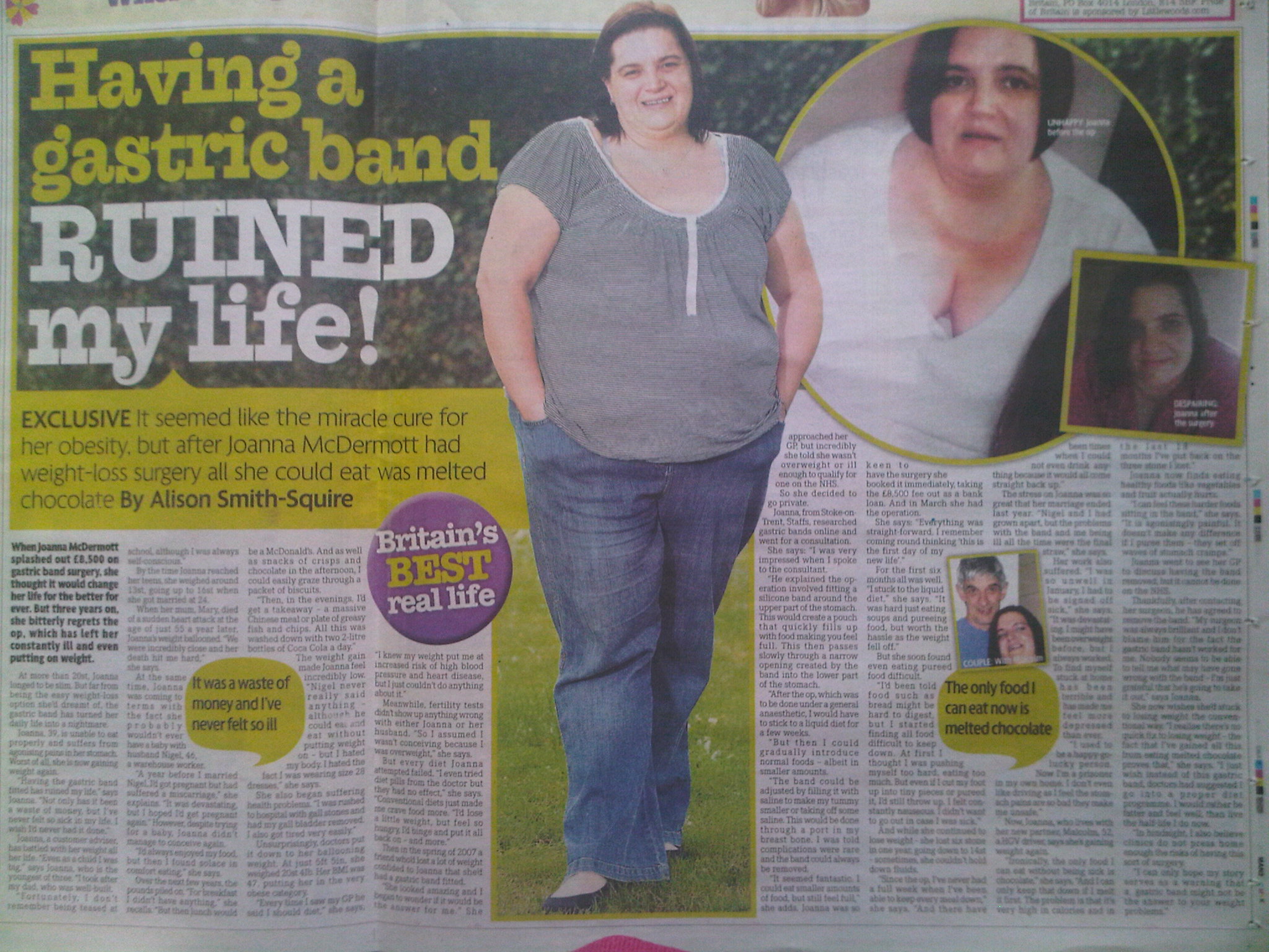 Gastric band surgery ruined my life... story sold to Daily Mirror