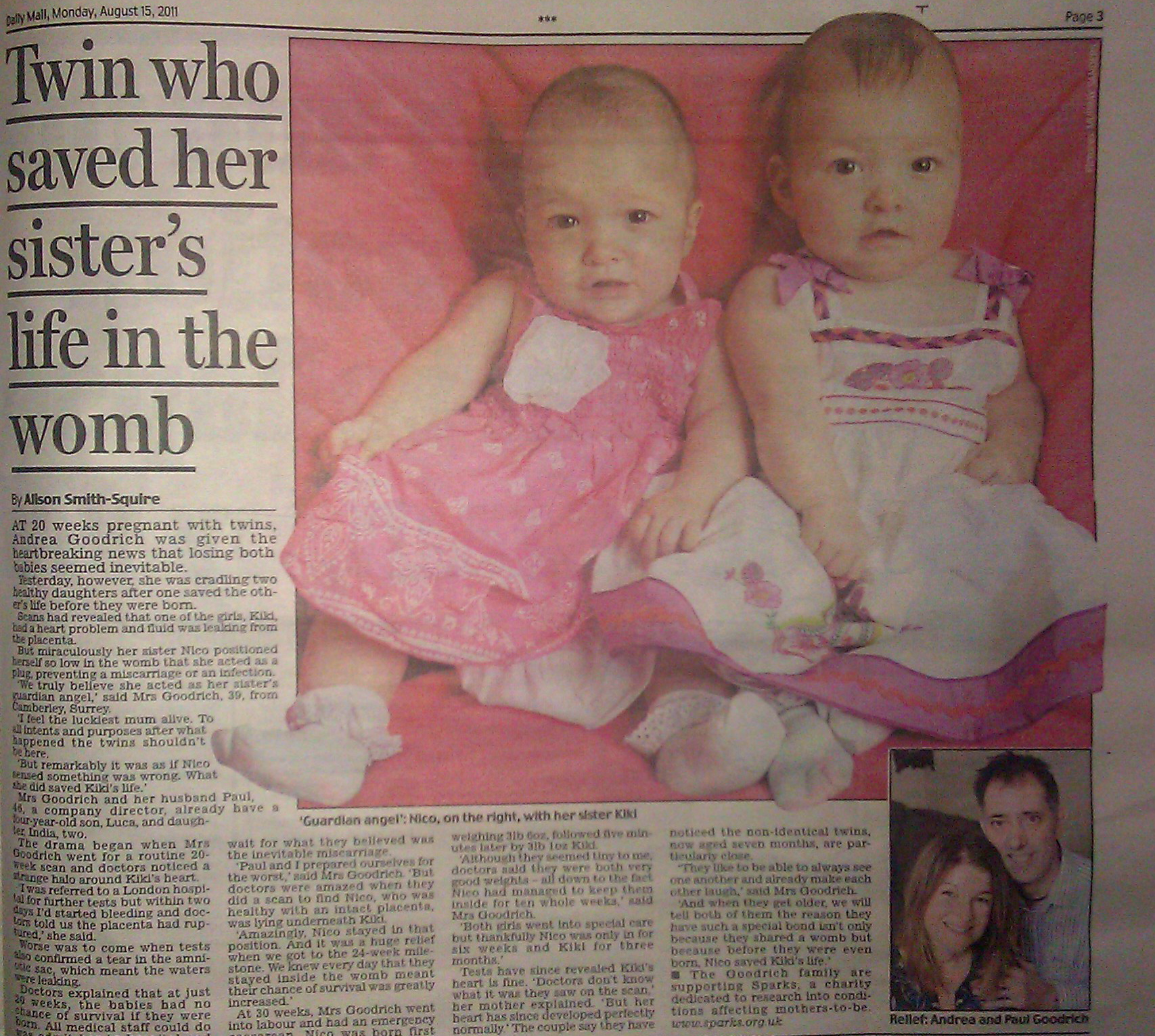 Twin saves her little sister's life in the womb...