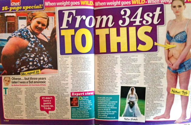 From fat to Anorexic - story in Chat magazine